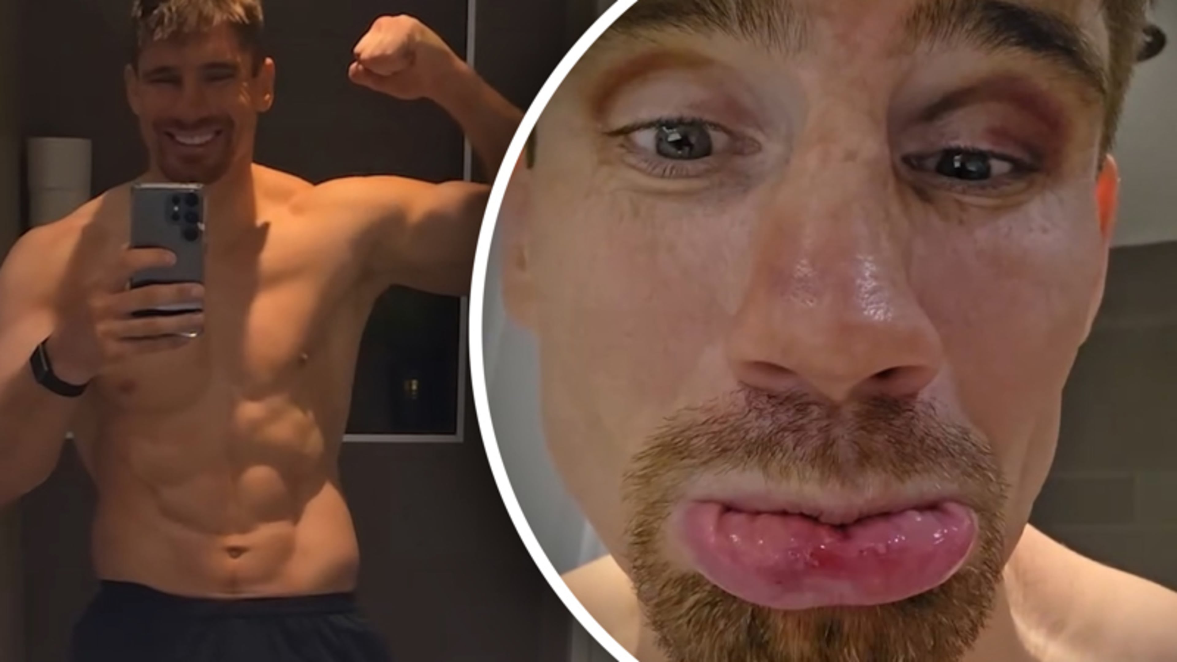 Gehavende Rico Verhoeven gaat op weegschaal staan: ‘Goed nieuws’