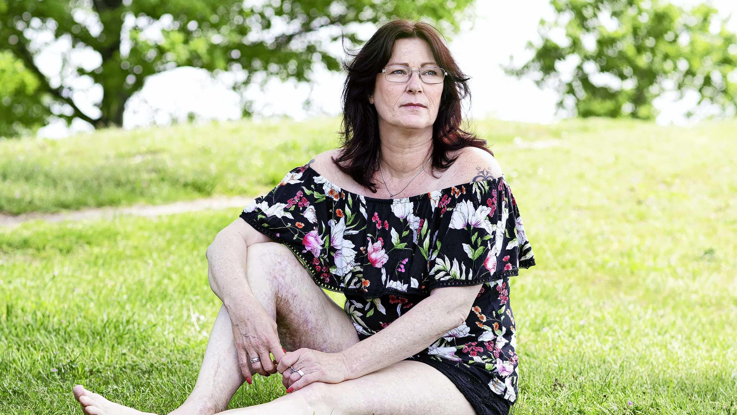 Conny (54) kreeg frituurolie over zich heen: ’Een vijfde van mijn lichaam was verbrand’