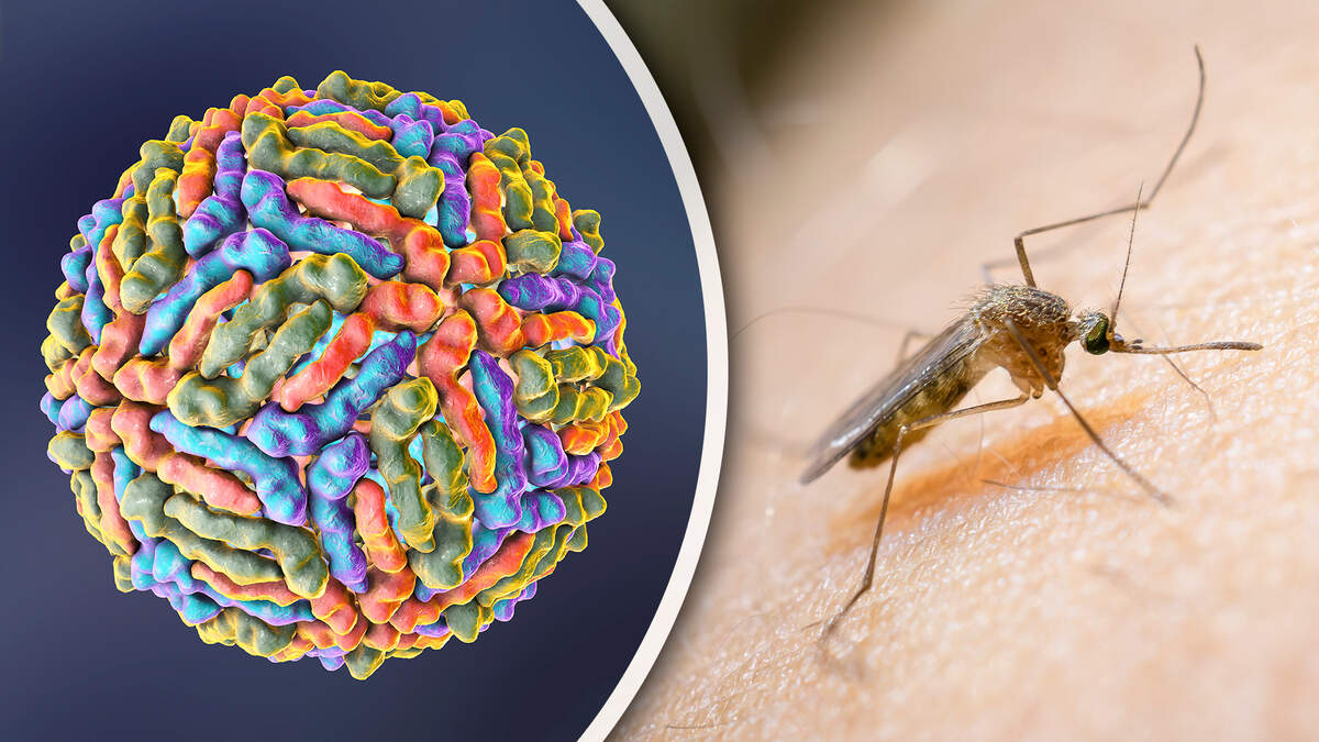 First death from West Nile virus reported in the Netherlands