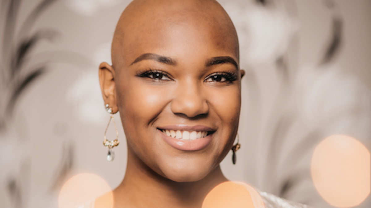 Milendi heeft alopecia: Ik leefde in angst | De Telegraaf