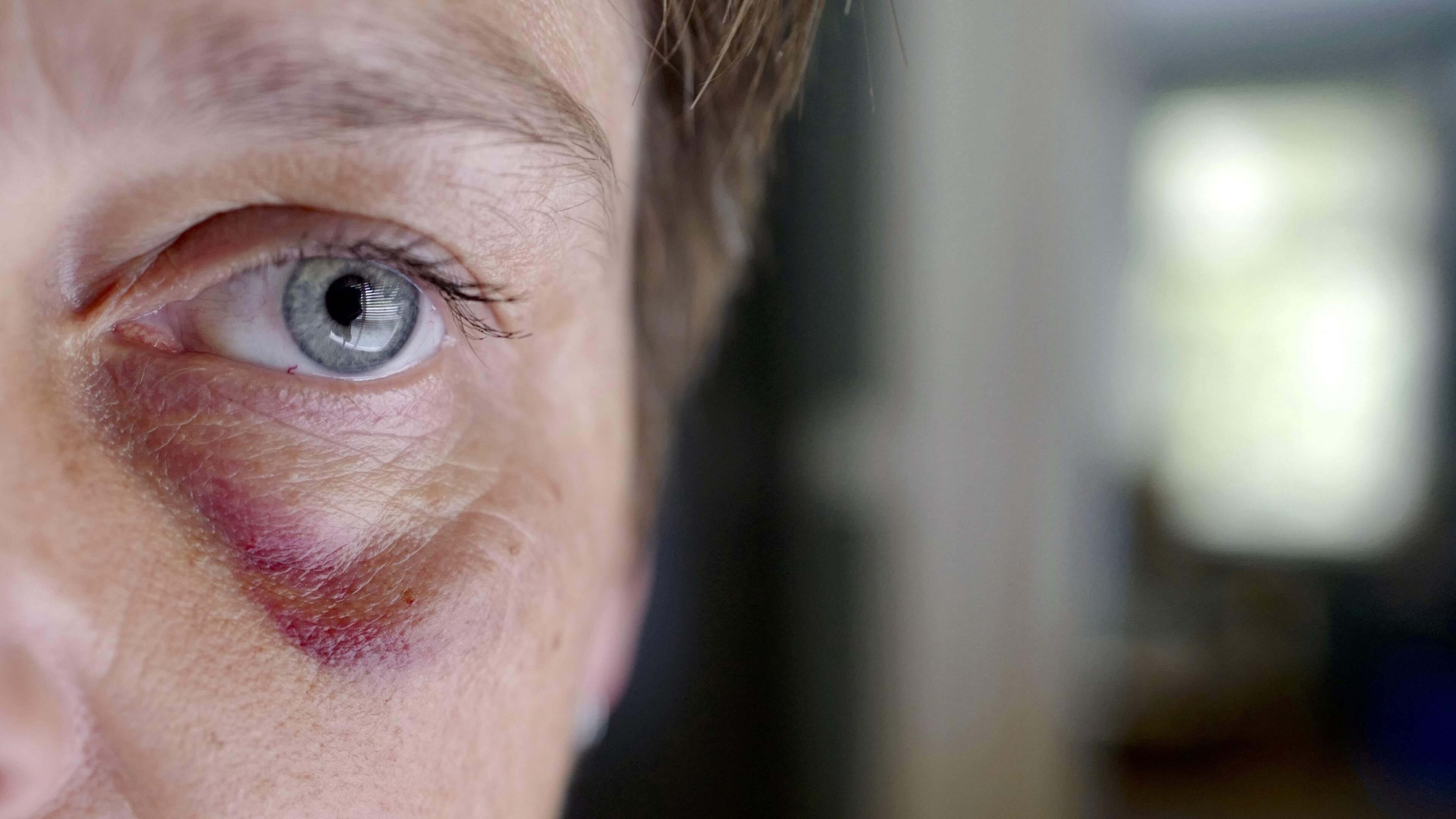 Meer dan 130.000 meldingen van huiselijk geweld in 2025