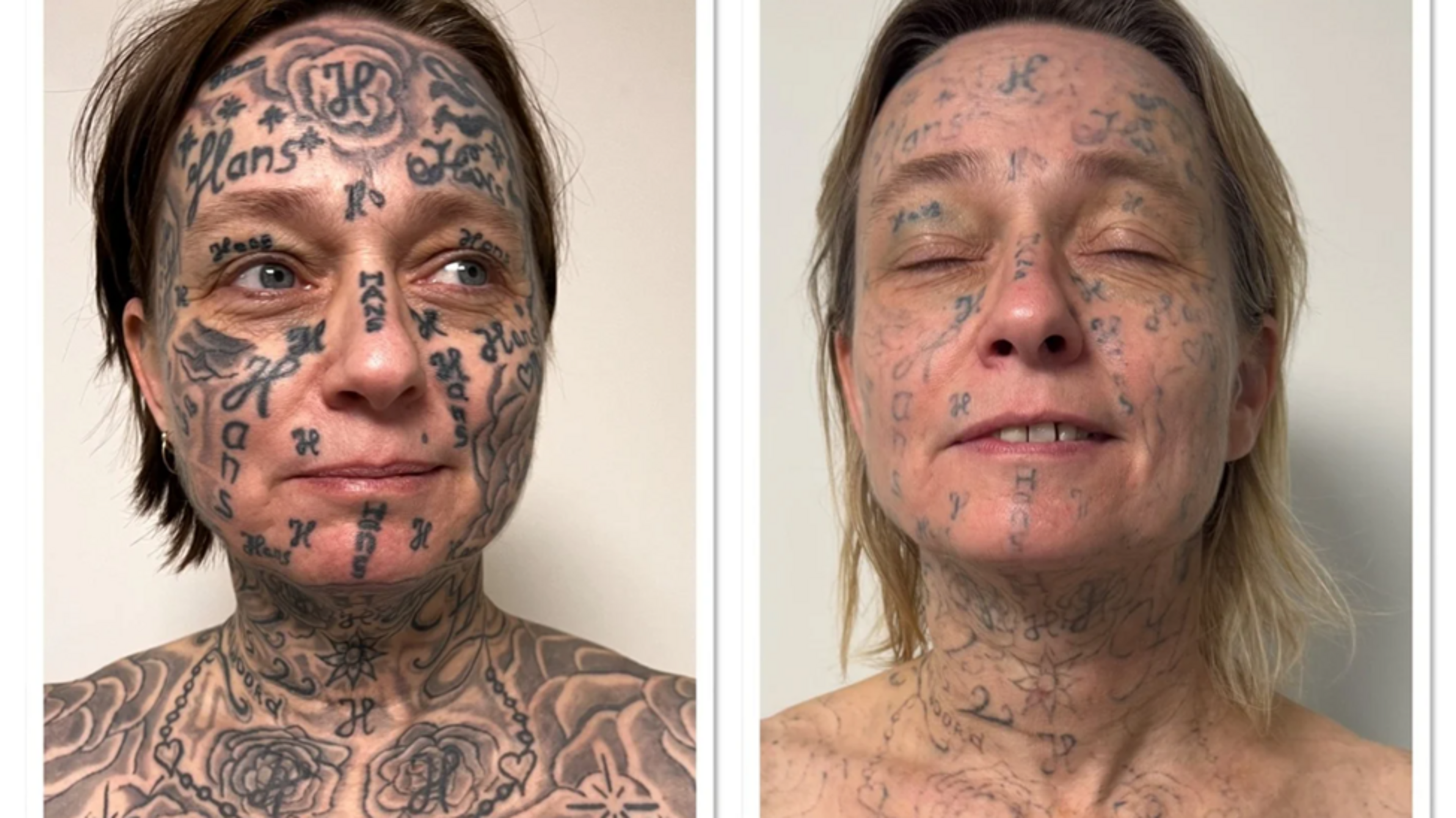 Crowdfunding voor Joke, wiens ex 250 keer zijn naam op haar lichaam tatoeëerde, geslaagd