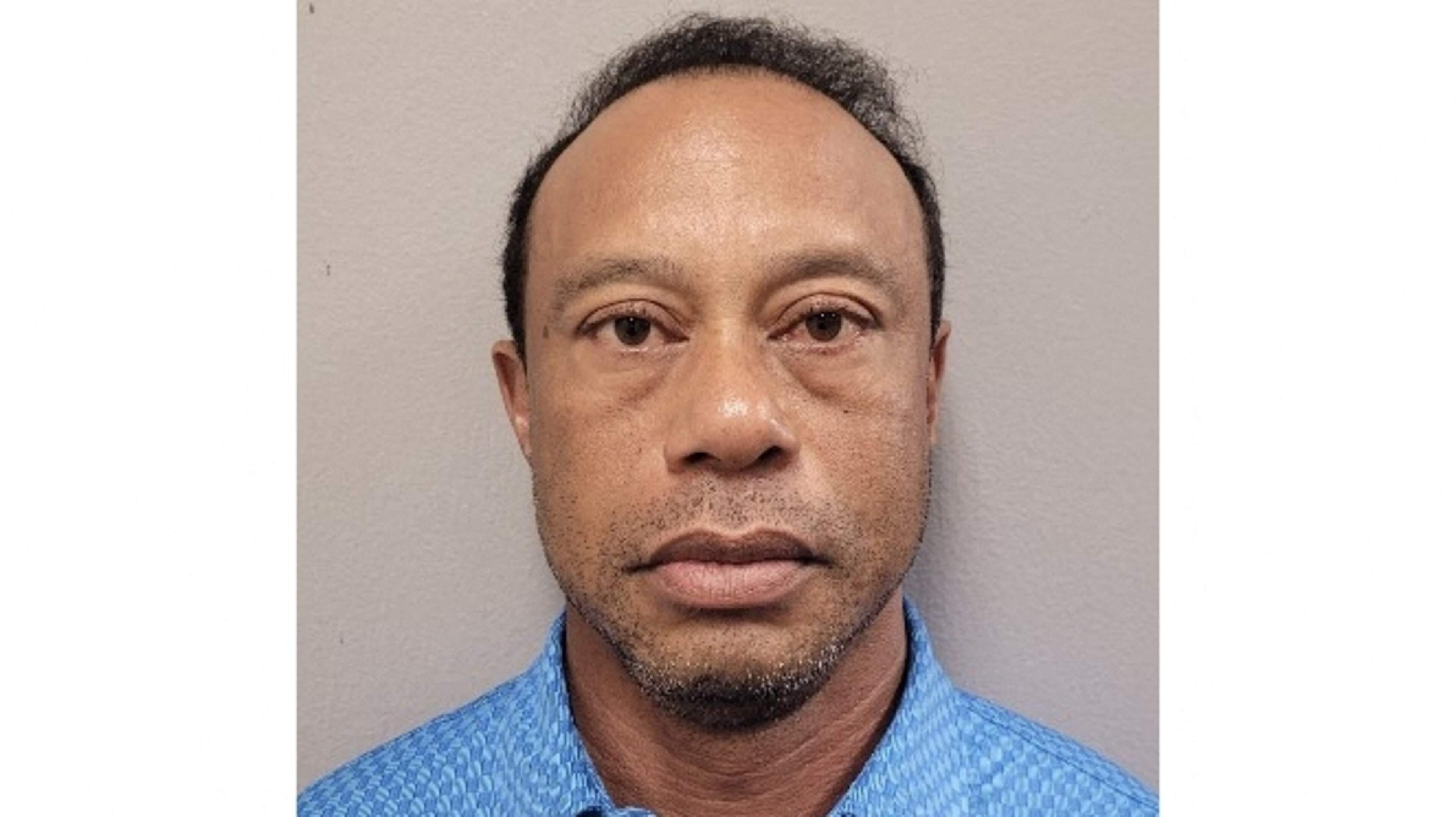 ’Hevig zwetende Tiger Woods had pillen op zak bij zware crash en arrestatie’